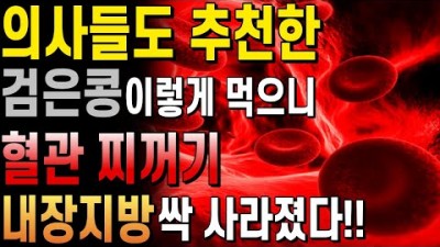 탈모 뱃살 다이어트 건강에 좋은 음식, 검은콩 효능 및 섭치 방법, 혈관에 좋은 음식, 내장 지방에 좋은 음식, 검은콩 먹는 방법