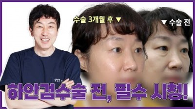 중년눈성형,눈밑처짐 하안검수술 추전 정보[압구정 김형진베이직성형외과]