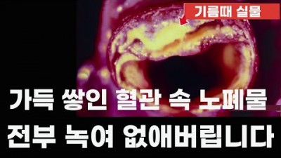 혈관 관리 방법, 막힌 혈관을 청소하고 피를 깨끗하게 만드는 가장 쉬운 4가지 방법, 올리브유, 비트,해조류,차전차피 정보