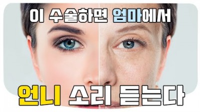 상안검 수술(쌍거플) 하안검 수술 부작용, 재수술 없으려면 알아야 할 것, 지방재배치 하안검 상안검 수술 중년성형 잘 받으려면