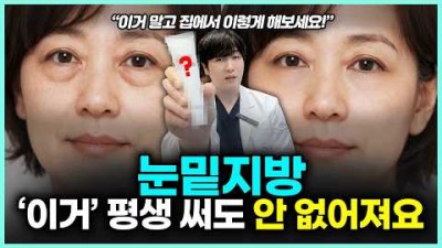 눈밑 지방 없애는 방법, 눈밑 처짐 관리 방법, 눈밑 처짐 지방 관리 방법, 아이 백 크림 효과 정보