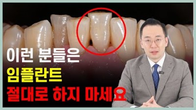 임플란트 치료를 받으면 안 되는 분들 케이스 정보(브릿지 재치료, 뼈가부족한경우, 신경치료기회를 줄수있을때) 및 우회 시술 방법 강남 임플란트 김준엽치과의원 제공