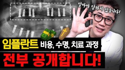 임플란트 과정 및 정보 대공개,  임플란트 구성 식립 수술과정, 수명 임플란트 정보 서울 중구 임플란트 최앤이치과 제공