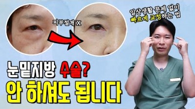 하안검 수술 눈밑지방 재배치, 수술없이 눈 밑지방 없애는 법 정보[청담이엘피부과- 본질남 - 젊음의 본질을 알려주는 남자]